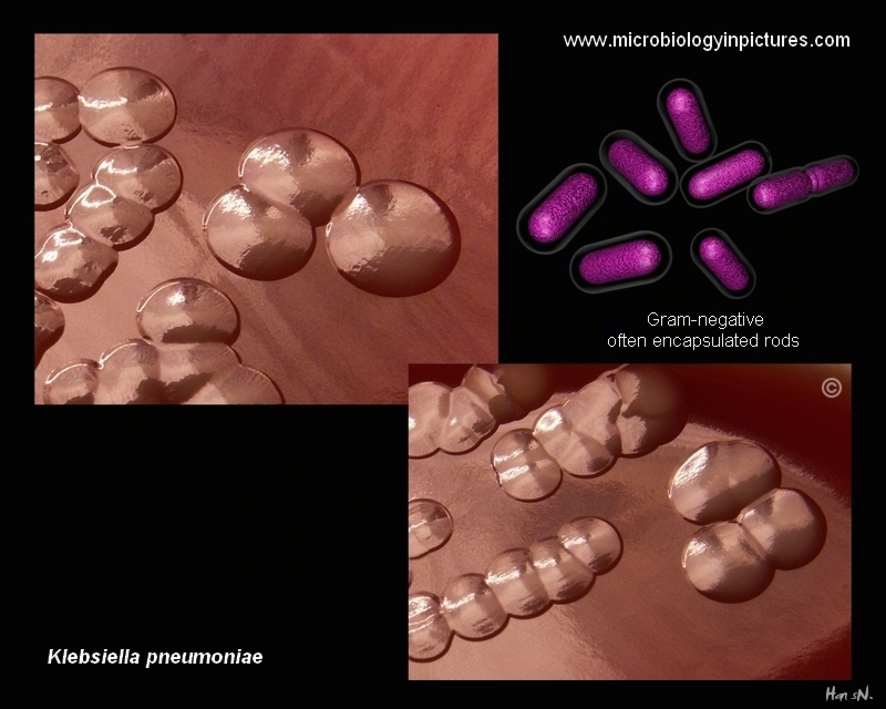 Klebsiella pneumoniae Colonies of Klebsiella pneumoniae